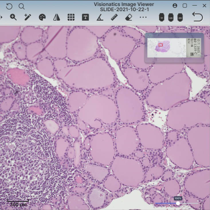 slice-image-analysis